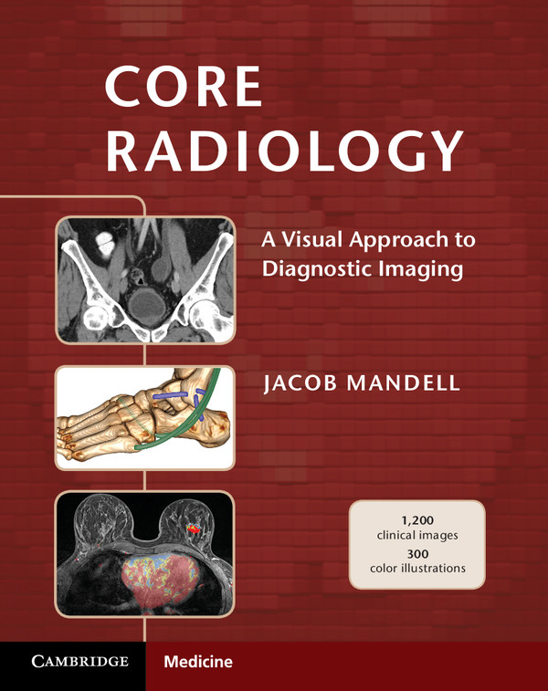 Core Radiology:A Visual Approach to Diagnostic Imaging ebook